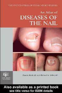 cover of the book An Atlas of Deseases of the Nail