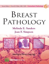 cover of the book Breast Pathology (Consultant Pathology Volume 6)