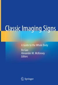 cover of the book Classic Imaging Signs: A Guide to the Whole Body