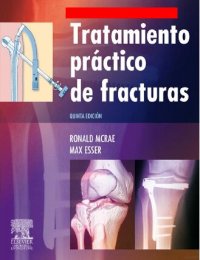 cover of the book Tratamiento Practico De Las Fracturas (5ed)