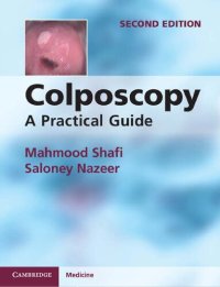 cover of the book Colposcopy: A Practical Guide