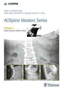 cover of the book Aospine Masters Series, Volume 4: Adult Spinal Deformities