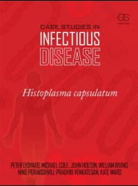 cover of the book Case Studies in Infectious Disease: Histoplasma Capsulatum