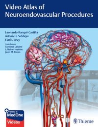 cover of the book Video Atlas of Neuroendovascular Procedures