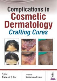 cover of the book Complications in Cosmetic Dermatology: Crafting Cures