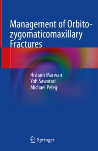 cover of the book Management of Orbito-zygomaticomaxillary Fractures