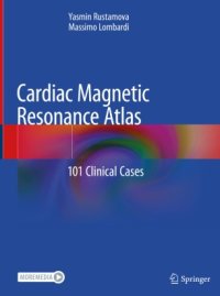 cover of the book Cardiac Magnetic Resonance Atlas: 101 Clinical Cases