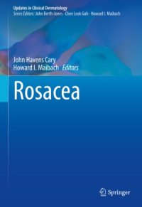 cover of the book Rosacea