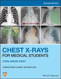 cover of the book Chest X-Rays for Medical Students: CXRs Made Easy