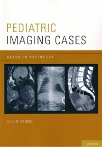 cover of the book Pediatric Imaging Cases (Cases in Radiology)