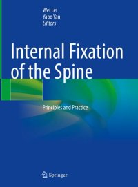 cover of the book Internal Fixation of the Spine: Principles and Practice