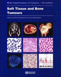 cover of the book Soft Tissue and Bone Tumours: WHO Classification of Tumours (Medicine)