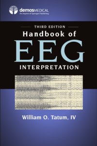 cover of the book Handbook of EEG Interpretation