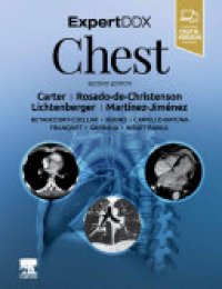 cover of the book ExpertDDx: Chest