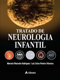 cover of the book Tratado de Neurologia Infantil (Em Portuguese do Brasil)