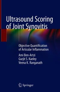 cover of the book Ultrasound Scoring of Joint Synovitis : Objective Quantification of Articular Inflammation