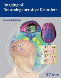 cover of the book Imaging of Neurodegenerative Disorders