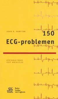 cover of the book 150 ECG-problemen