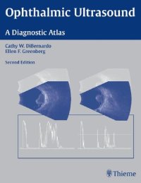 cover of the book Ophthalmic Ultrasound: A Diagnostic Atlas