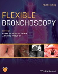 cover of the book Flexible bronchoscopy