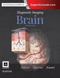 cover of the book Diagnostic imaging : Brain