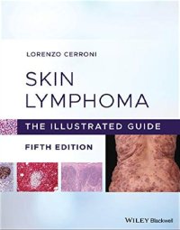 cover of the book Skin lymphoma. The illustrated guide