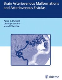 cover of the book Brain arteriovenous malformations and arteriovenous fistulas