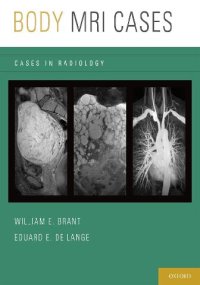 cover of the book Body MRI cases