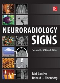 cover of the book Neuroradiology signs