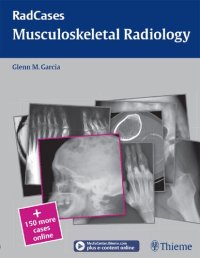 cover of the book Radcases musculoskeletal radiology.