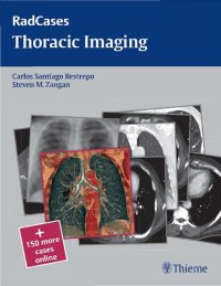 cover of the book RadCases thoracic imaging