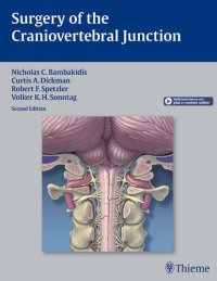 cover of the book Surgery of the craniovertebral junction.