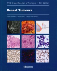 cover of the book Breast Tumours: WHO Classification of Tumours