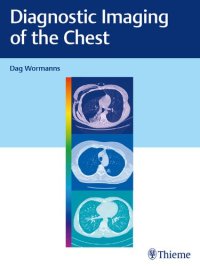 cover of the book Diagnostic Imaging of the Chest