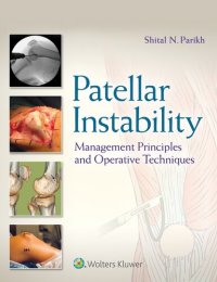 cover of the book Patellar Instability: Management Principles and Operative Techniques