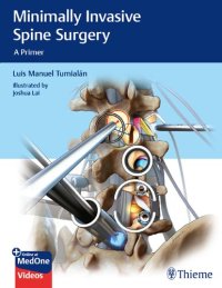 cover of the book Minimally Invasive Spine Surgery: A Primer