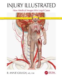 cover of the book Injury Illustrated: How Medical Images Win Legal Cases