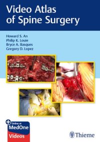 cover of the book Video Atlas of Spine Surgery