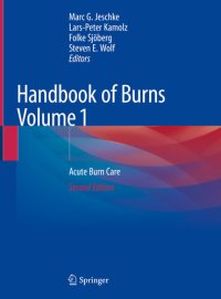 cover of the book Handbook of Burns Volume 1: Acute Burn Care