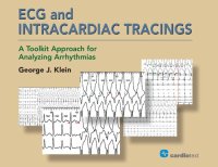 cover of the book ECG and Intracardiac Tracings: A Toolkit Approach for Analyzing Arrhythmias