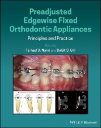 cover of the book Preadjusted Edgewise Fixed Orthodontic Appliances: Principles and Practice