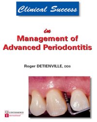 cover of the book Clinical Success in Management of Advanced Periodontitis