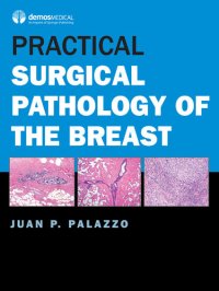 cover of the book Practical Surgical Pathology of the Breast