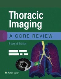 cover of the book Thoracic Imaging: A Core Review