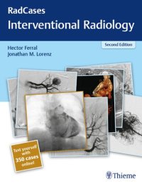 cover of the book Radcases Interventional Radiology