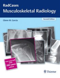 cover of the book Radcases Musculoskeletal Radiology