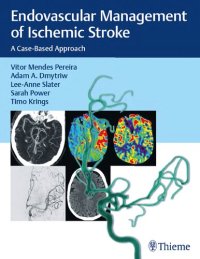 cover of the book Endovascular Management of Ischemic Stroke: A Case-based Approach