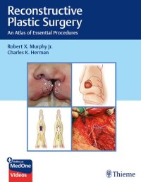 cover of the book Reconstructive Plastic Surgery: An Atlas of Essential Procedures