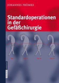 cover of the book Standardoperationen in der Gefäßchirurgie