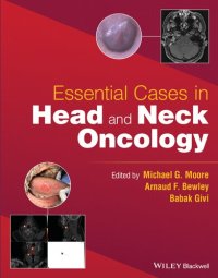 cover of the book Essential Cases in Head and Neck Oncology